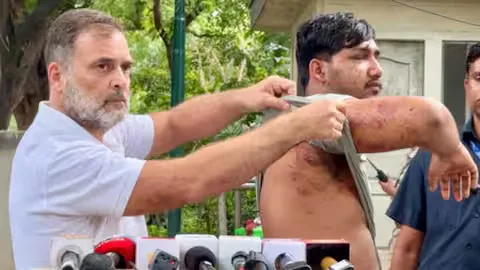 Rahul Gandhi accused the Centre of denying pellet use during the CJP’s Jantar Mantar protest and demanded accountability over alleged injuries sustained by a student during the police crackdown.